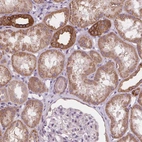 Anti-RAB20 Antibody