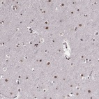 Anti-RRAGD Antibody