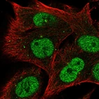 Immunofluorescent staining of human cell line SK-MEL-30 shows localization to nucleoplasm & centrosome.
