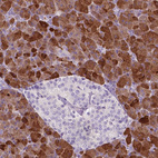 Immunohistochemical staining of human pancreas shows strong membranous and cytoplasmic positivity in exocrine glandular cells.