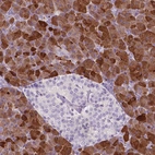 Immunohistochemical staining of human pancreas shows strong membranous and cytoplasmic positivity in exocrine glandular cells.