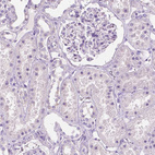 Immunohistochemical staining of human kidney shows no positivity in cells in tubules as expected.