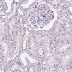 Immunohistochemical staining of human kidney shows no positivity in cells in tubules as expected.