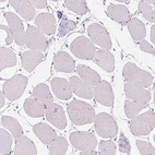 Immunohistochemical staining of human skeletal muscle shows no positivity in myocytes as expected.