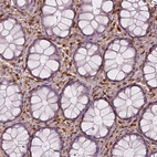Immunohistochemical staining of human rectum shows strong cytoplasmic positivity in lymphoid cells.
