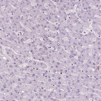 Immunohistochemical staining of human liver shows no positivity in hepatocytes as expected.