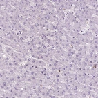 Immunohistochemical staining of human liver shows no positivity in hepatocytes as expected.