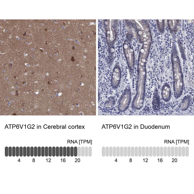 Anti-ATP6V1G2 Antibody