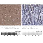Anti-ATP6V1G2 Antibody