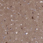 Immunohistochemical staining of human cerebral cortex shows high expression.