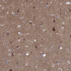 Immunohistochemical staining of human cerebral cortex shows high expression.
