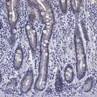 Immunohistochemical staining of human duodenum shows low expression as expected.