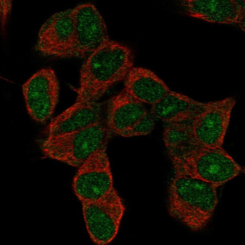 Anti-HOXD9 Antibody
