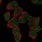 Anti-HOXD9 Antibody