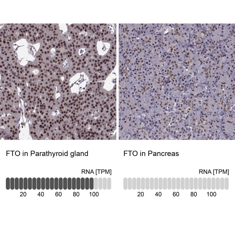 Anti-FTO Antibody