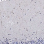 Anti-KRT222 Antibody