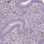 Immunohistochemical staining of human endometrium shows strong cytoplasmic positivity in lymphoid cells.