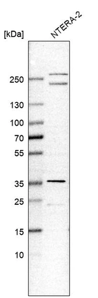 Western blot analysis in human cell line NTERA-2.