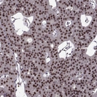 Immunohistochemical staining of human parathyroid gland shows high expression.