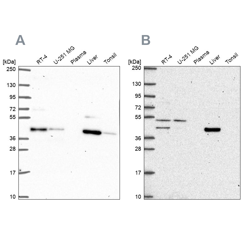 Anti-PHKG2 Antibody