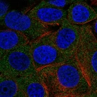 Immunofluorescent staining of human cell line MCF7 shows localization to cytosol.