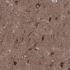 Anti-CLPTM1 Antibody