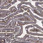Anti-DPP4 Antibody