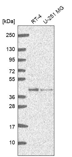 Anti-GMPR2 Antibody