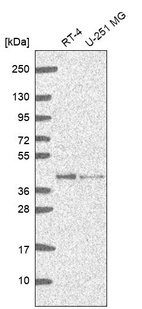 Anti-GMPR2 Antibody