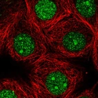 Immunofluorescent staining of human cell line MCF7 shows localization to nucleus & nucleoli.