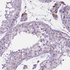 Anti-CECR6 Antibody