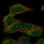 Immunofluorescent staining of human cell line SH-SY5Y shows localization to nucleoplasm & vesicles.