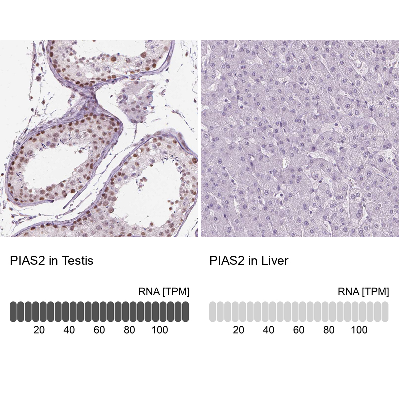 Anti-PIAS2 Antibody