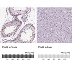 Anti-PIAS2 Antibody