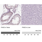 Anti-PIAS2 Antibody