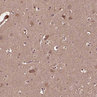 Immunohistochemical staining of human cerebral cortex shows weak to moderate cytoplasmic positivity in neurons.