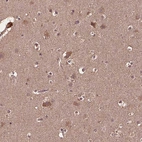 Immunohistochemical staining of human cerebral cortex shows weak to moderate cytoplasmic positivity in neurons.