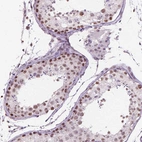 Immunohistochemical staining of human testis shows moderate nuclear positivity in cells in seminiferous ducts.