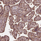 Immunohistochemical staining of human placenta shows moderate cytoplasmic positivity in trophoblastic cells.