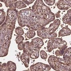 Immunohistochemical staining of human placenta shows moderate cytoplasmic positivity in trophoblastic cells.