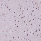 Immunohistochemical staining of human cerebral cortex shows moderate nuclear positivity in neurons.