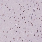 Immunohistochemical staining of human cerebral cortex shows moderate nuclear positivity in neurons.
