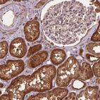 Immunohistochemical staining of human kidney shows strong cytoplasmic positivity in cells in tubules.