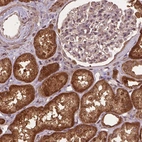 Immunohistochemical staining of human kidney shows strong cytoplasmic positivity in cells in tubules.