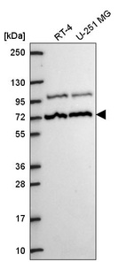 Anti-MED25 Antibody
