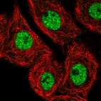 Immunofluorescent staining of human cell line A549 shows localization to nucleoplasm.