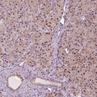 Anti-SQSTM1 Antibody