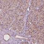 Anti-SQSTM1 Antibody