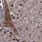 Anti-HPX Antibody