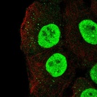 Immunofluorescent staining of human cell line HaCaT shows localization to nucleoplasm & vesicles.
